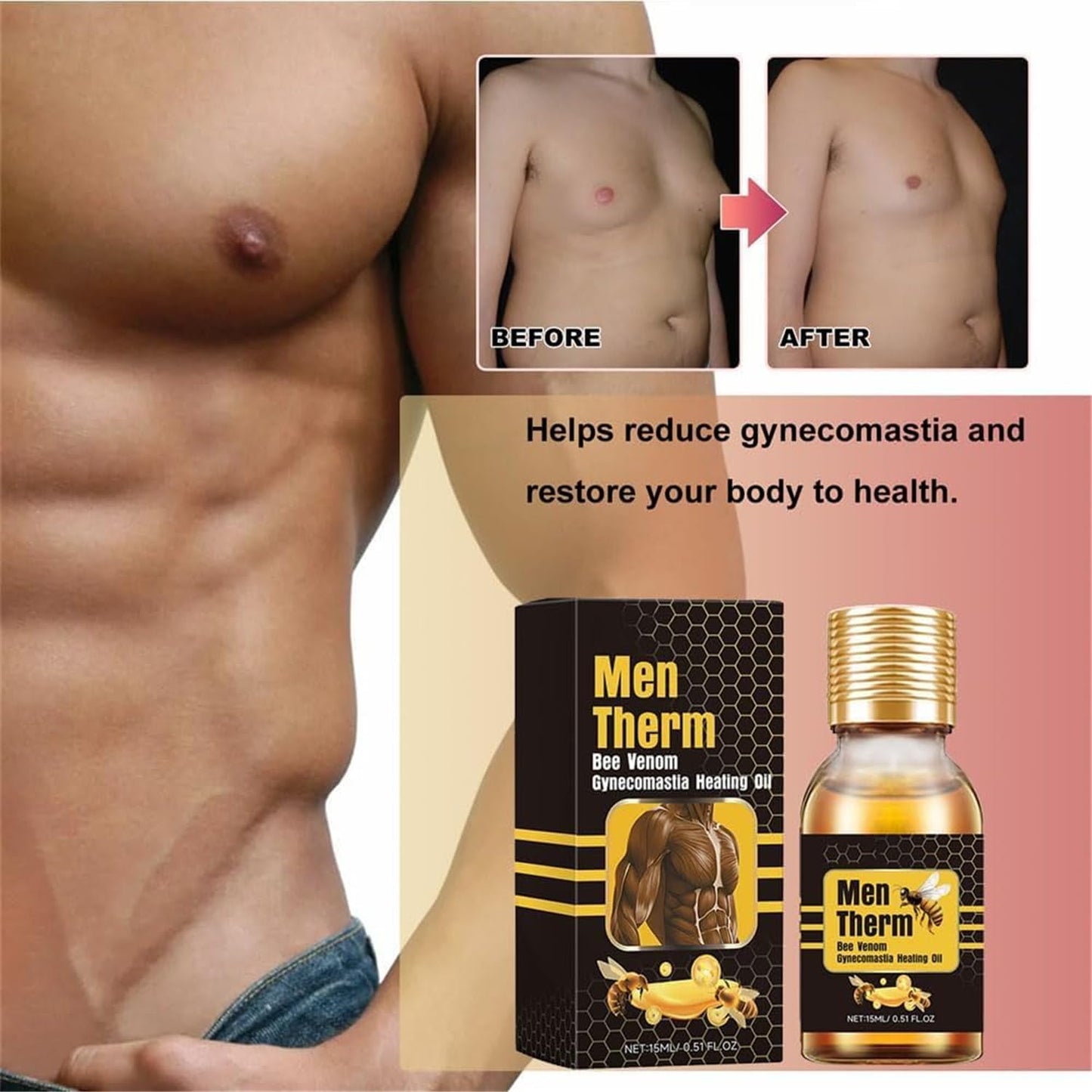 Men Therm Bee Venom Gynecomastia Heating Oil (Pack of 2)